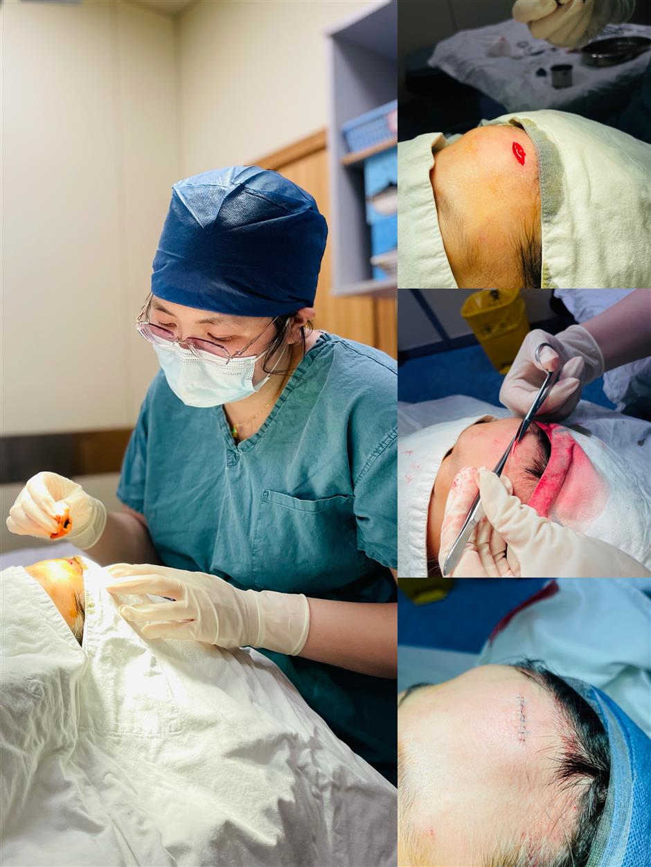 emergency cosmetic suturing available at xinhua hospital